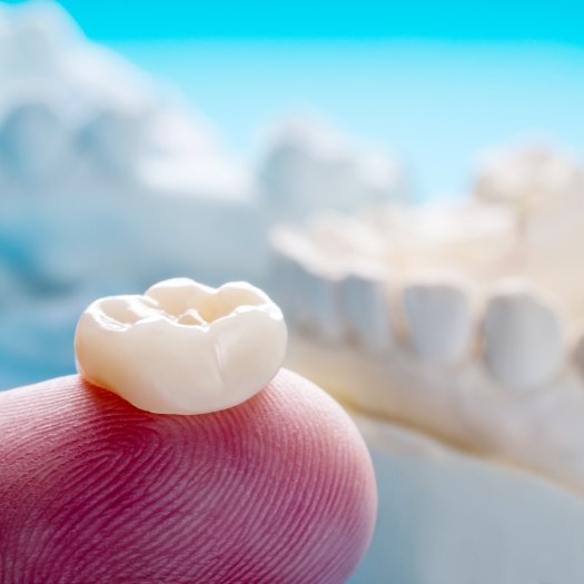 Dental crown resting on a finger