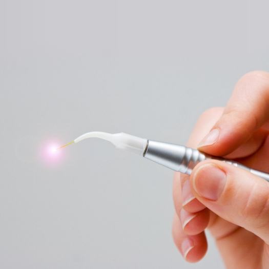 Hand holding a small metal dental laser device