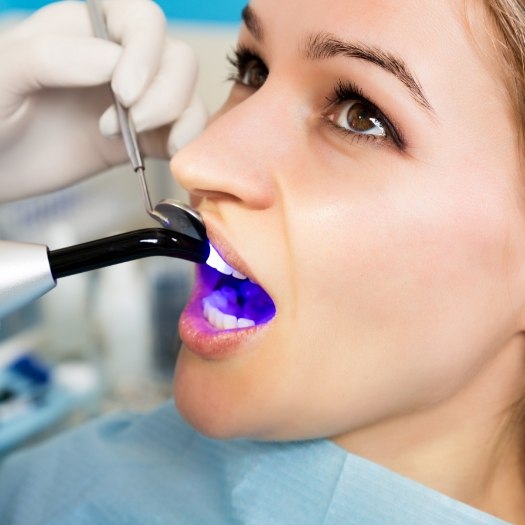 Dental patient receiving cosmetic bonding on a front upper tooth