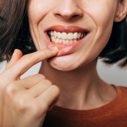 Woman pointing to her gums after gum disease treatment in San Antonio