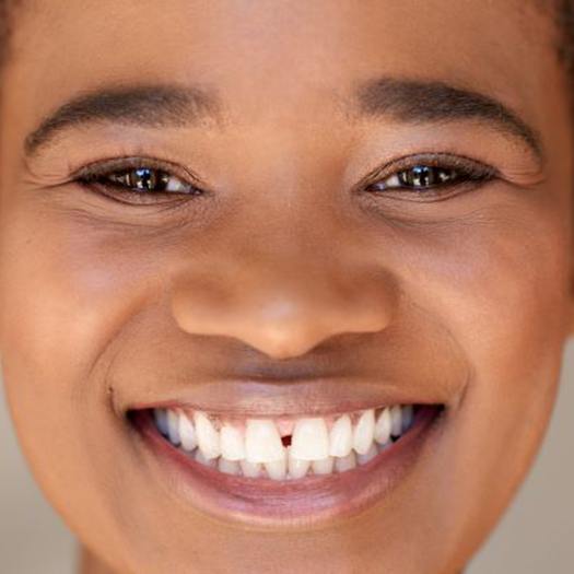Smiling woman with a gap between her front teeth