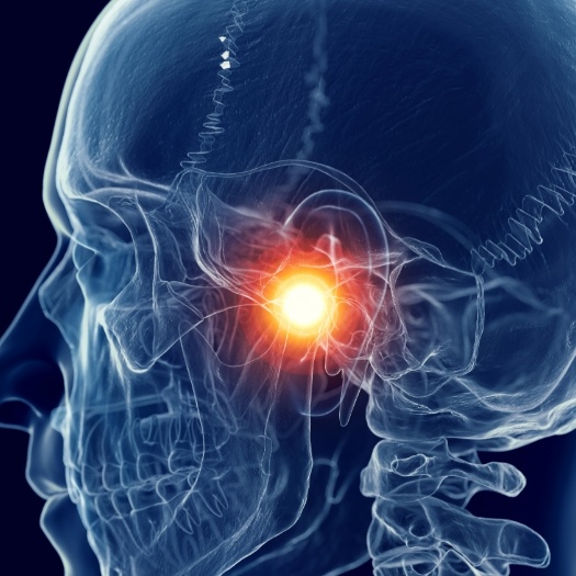 Illustrated side X ray of head with jaw joint highlighted