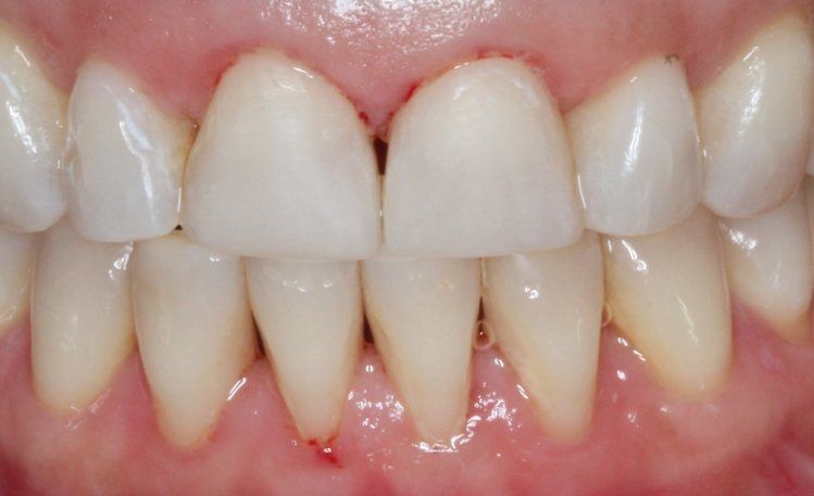 Mouth with brighter teeth