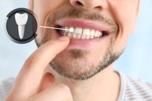 Smiling man pointing to his dental implant